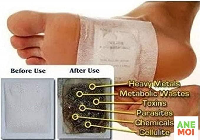 Detox Foot Patches (Set of 10)