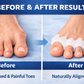 ⭐ ToeRelief Pro -  Instant Pain Relief