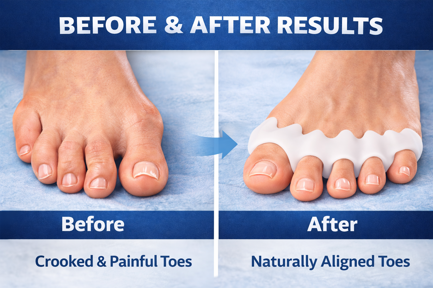 ⭐ ToeRelief Pro -  Instant Pain Relief