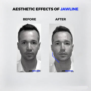 JawFlex Pro - Jaw Trainer