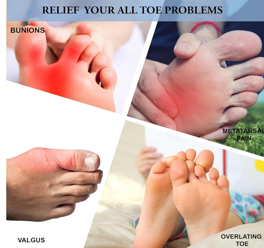 ⭐ ToeRelief Pro -  Instant Pain Relief