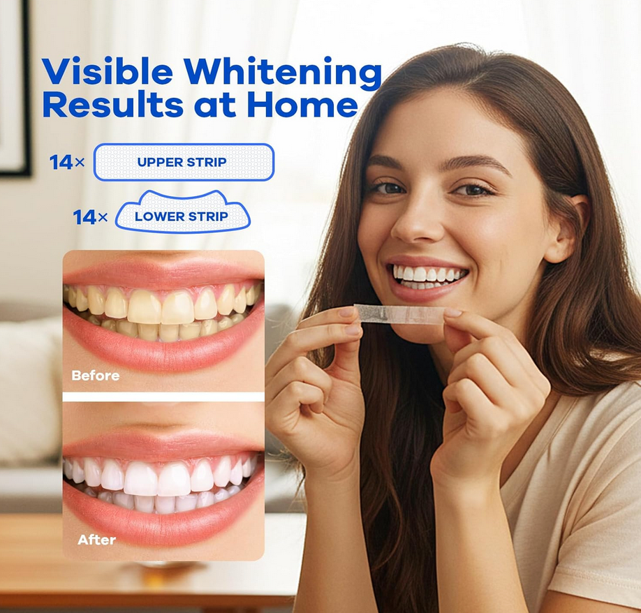 SmileLuxe™ Teeth Whitening Strips