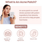 InvisiClear™ Acne Hydrocolloid Pimple Patch
