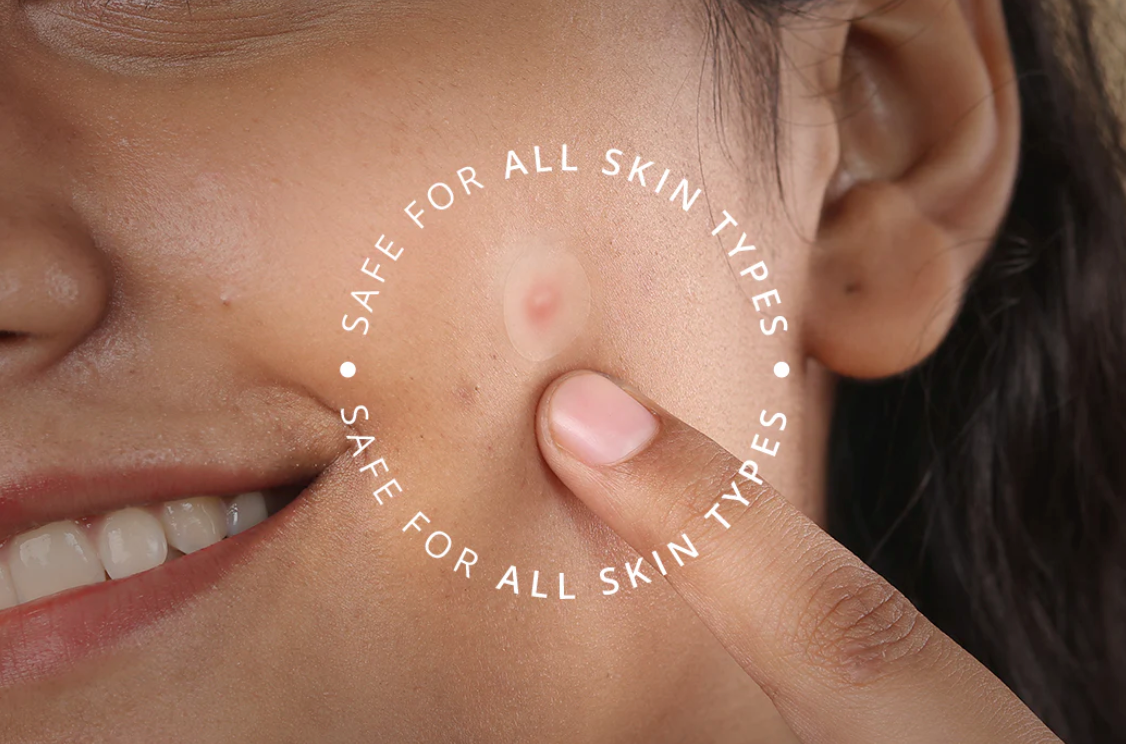 InvisiClear™ Acne Hydrocolloid Pimple Patch