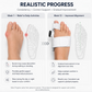 ToeFix Bunion Corrector