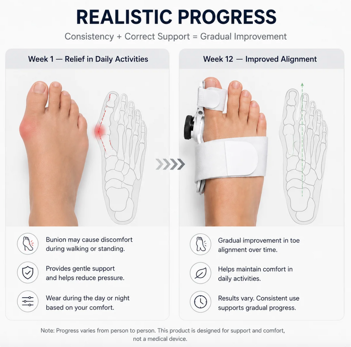 ToeFix Bunion Corrector