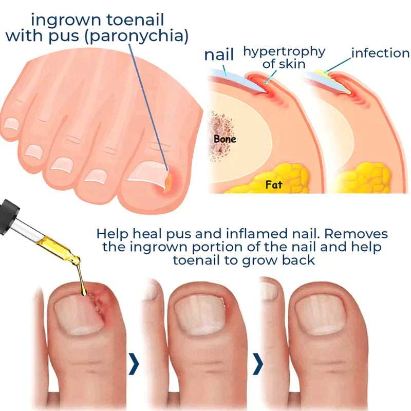 Natural Nails Strong Oil For Cuticle Care, Nail Growth & Strength